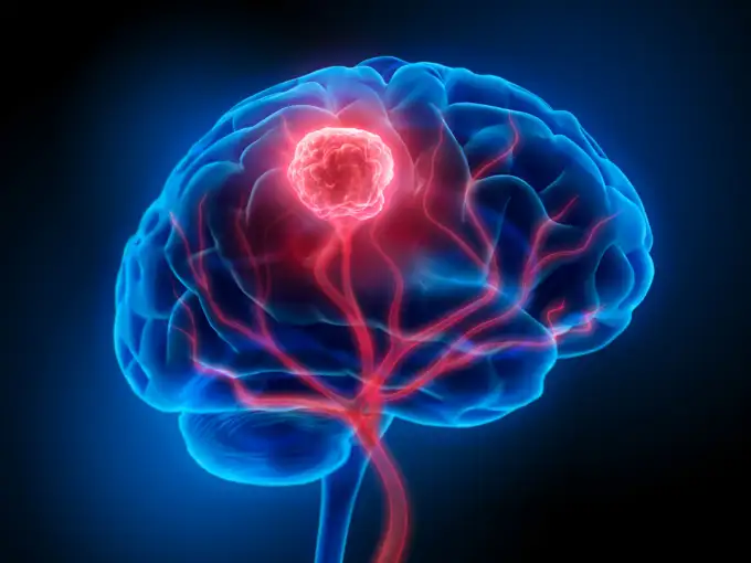 Brain 3 antar