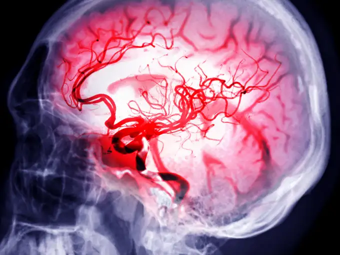 Brain 5
