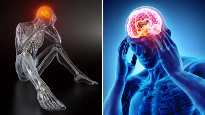 के हो  ब्रेन ट्युमर र स्ट्रोक ? ढिलो भए ज्यान जान सक्छ
