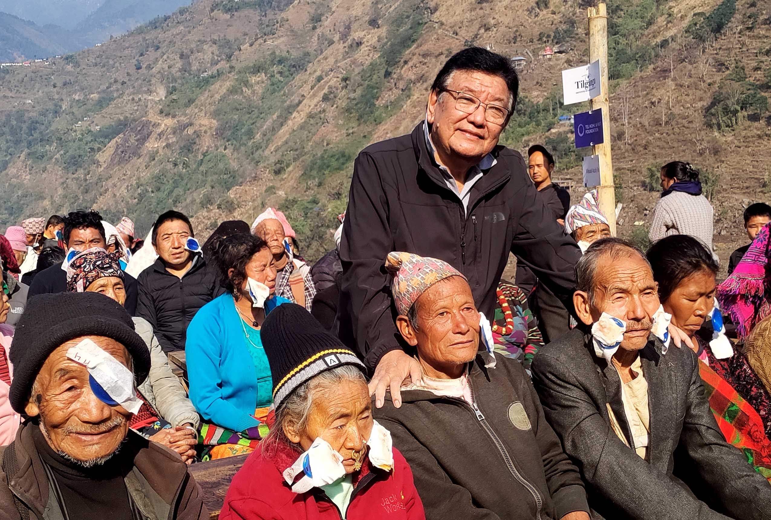 दुर्गम गाउँका ७० जना मोतियाविन्दु बिरामीको शल्यक्रिया