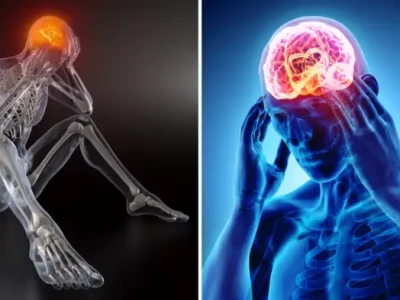 के हो  ब्रेन ट्युमर र स्ट्रोक ? ढिलो भए ज्यान जान सक्छ
